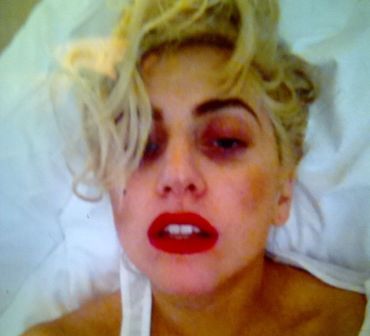 Lady Gaga Pamer Cincin Tunangan
