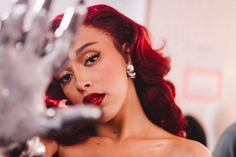 Gara-gara Operasi Amandel Doja Cat Batalkan Tur Konsernya